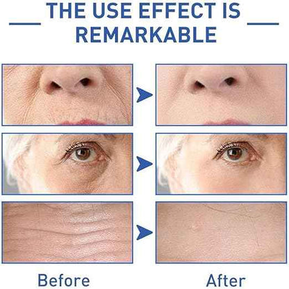 SADOER Retinol Caffeine Anti-Wrinkle Eye Cream – Dark Circle & Puffiness Reducer