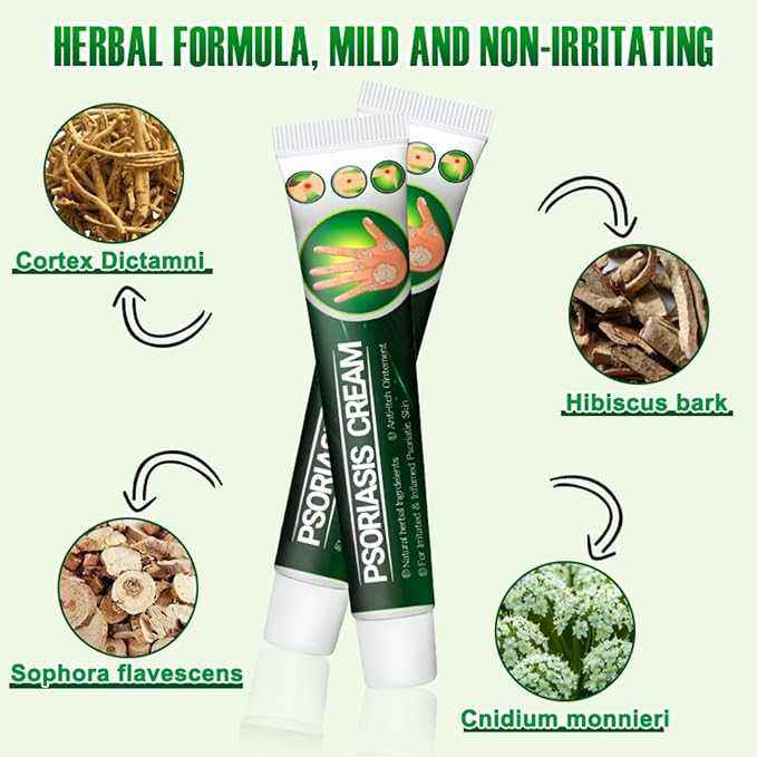 Psoriasis Cream - Herbal Plant Extracts